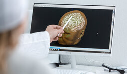 Mann zeigt einen Hirnscan auf Monitor